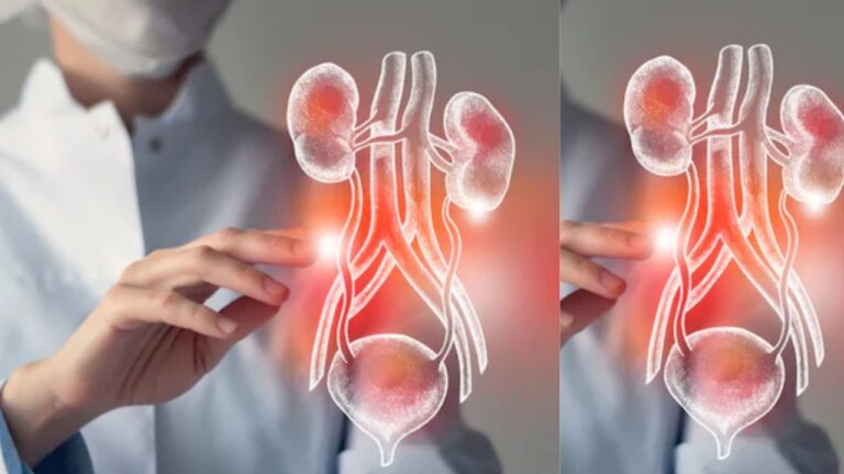 Eating Right After a Kidney Transplant