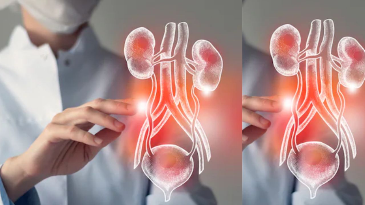 Eating Right After a Kidney Transplant